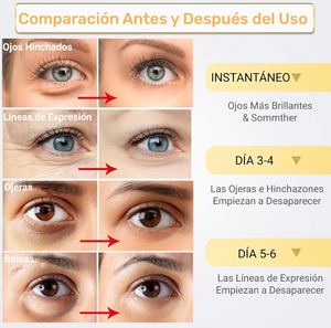 Parches de Colágeno para Ojeras